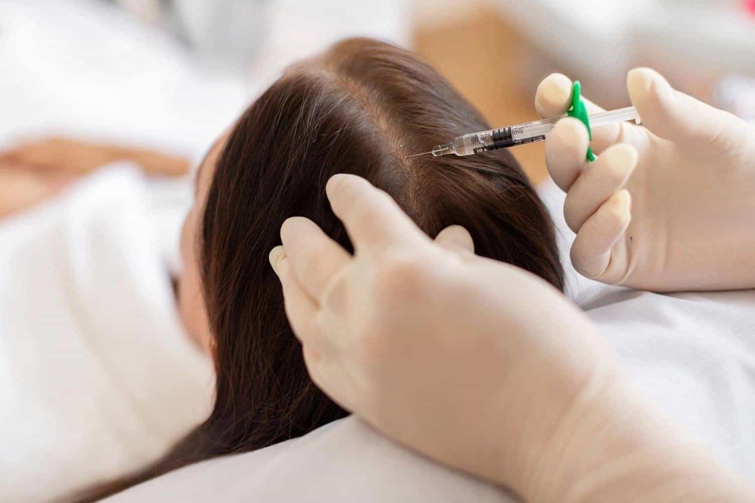Non-Surgical Hair Loss Treatments