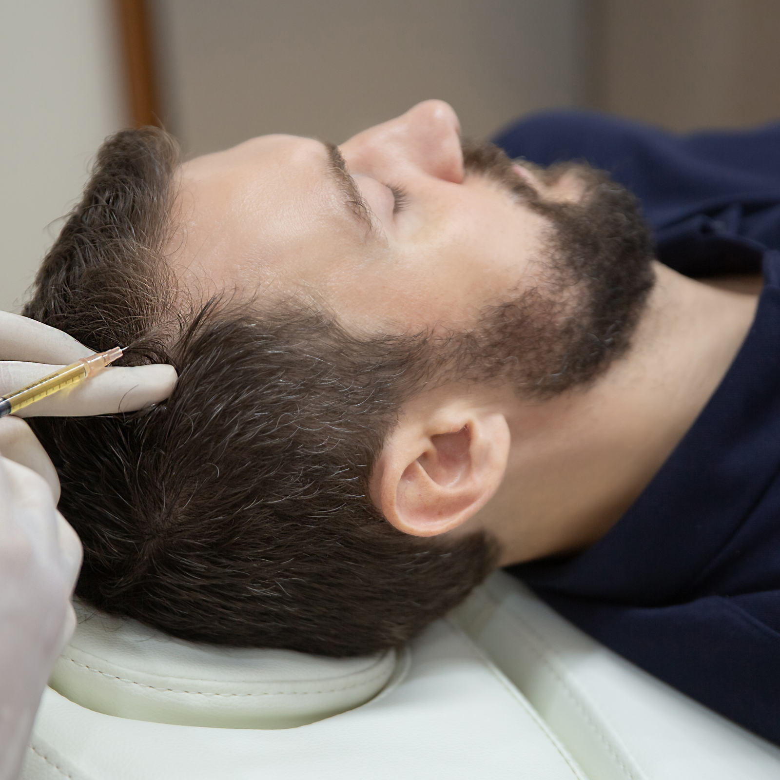 Non-surgical scalp treatment